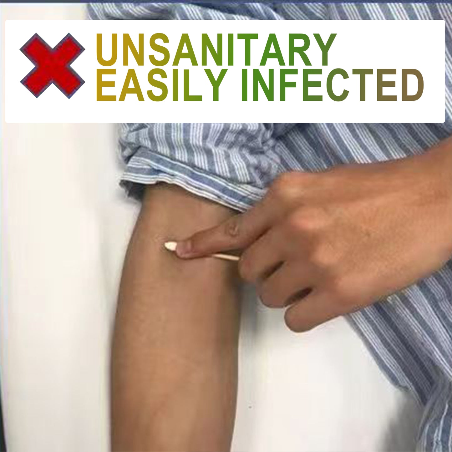 Nursing Hemostatic Clips