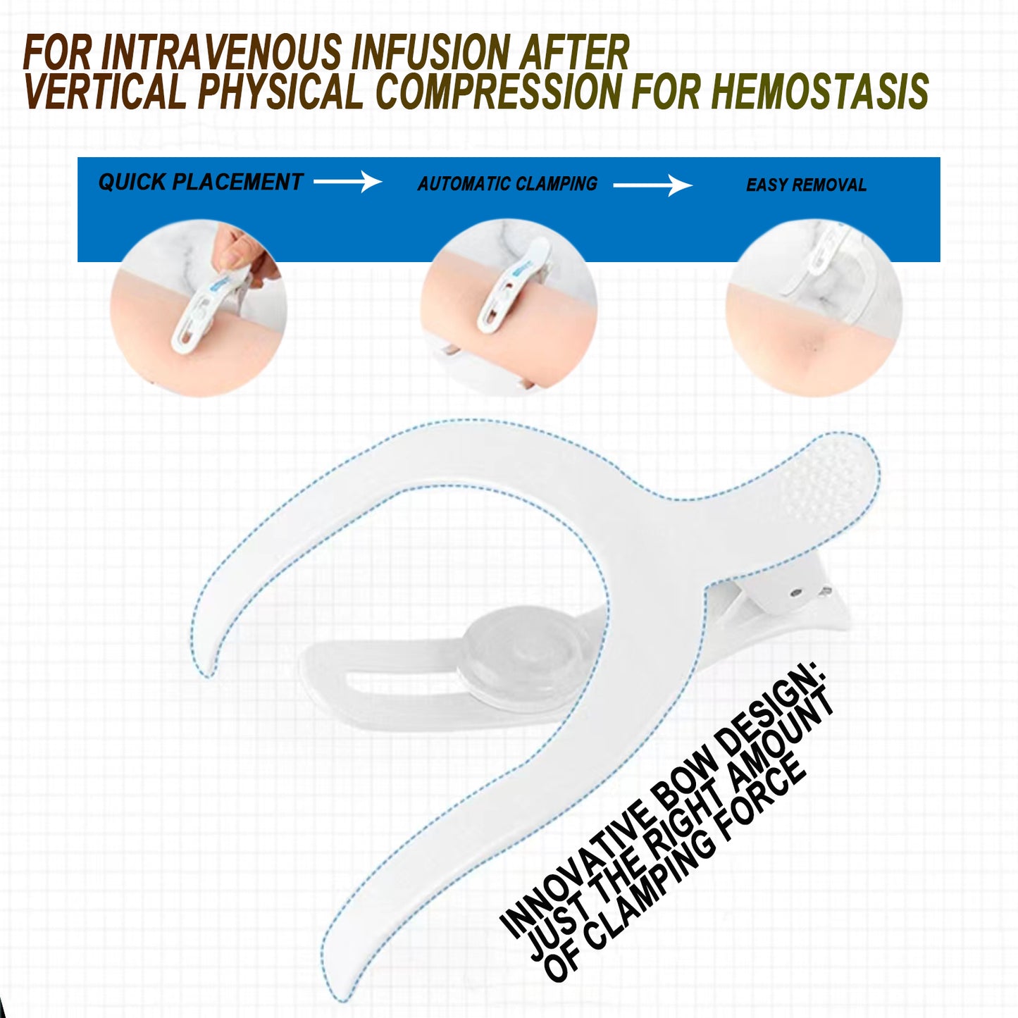 Nursing Hemostatic Clips