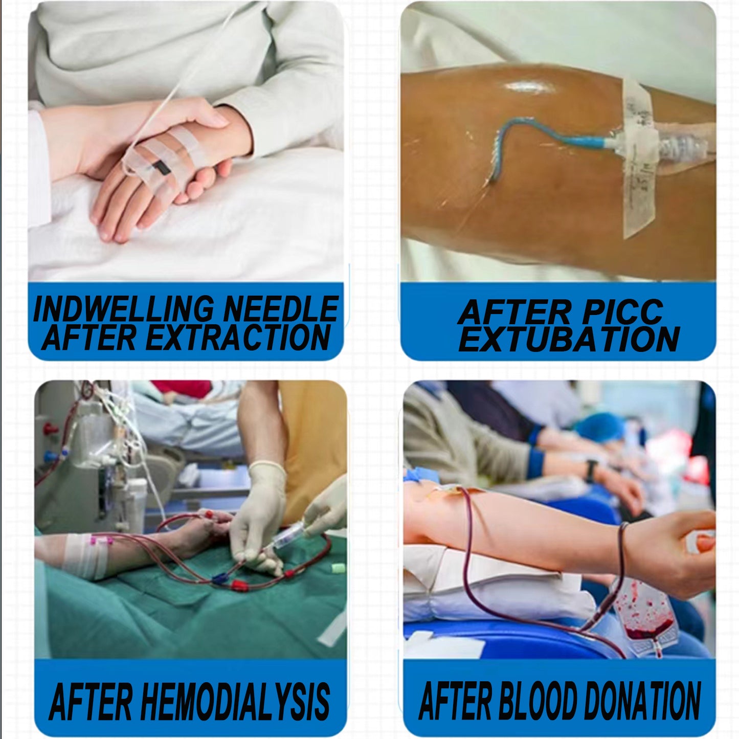 Nursing Hemostatic Clips