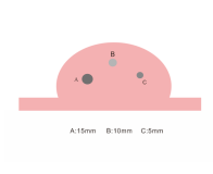 SZEMENTMD Breast Ultrasound Puncture Model