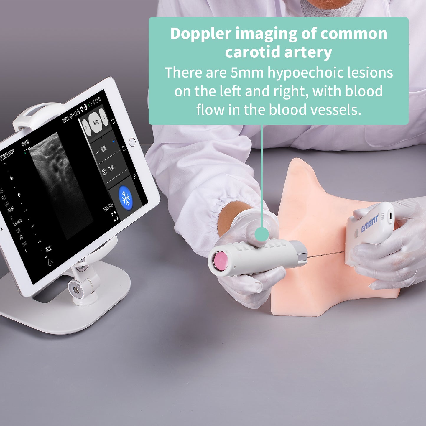 SZEMENTMD Thyroid Ultrasound Puncture Model EMM-JB
