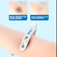 Nursing Hemostatic Clips