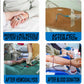 Nursing Hemostatic Clips