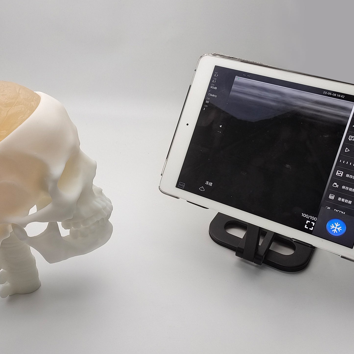 Ultrasonic Puncture Skull Cerebrum Model, Simulated Ultrasound Skull Cerebrum Exploration