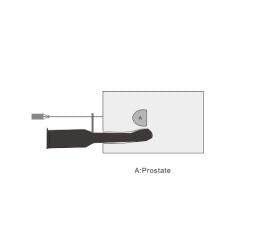 SZEMENTMD Prostate ultrasound puncture model EMM-QA